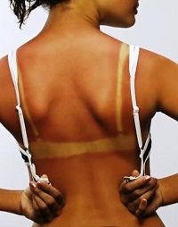 suntan